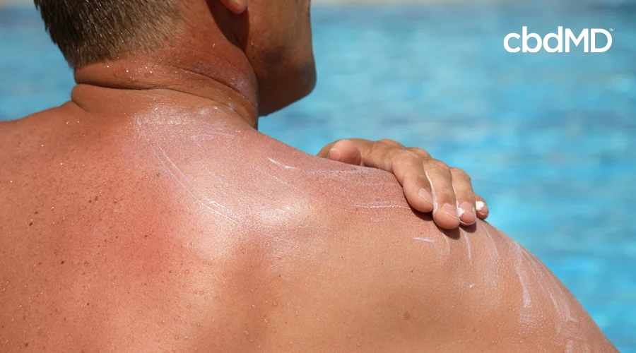 A man at a swimming pool applies sunscreen to his bare shoulders