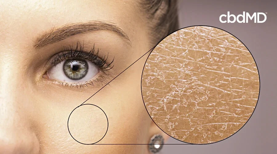 A woman's face shows an enlarged segment of of skin