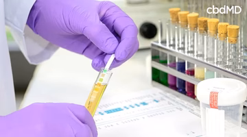 Lab technician with purple gloves testing urine sample using a drug test strip in laboratory.